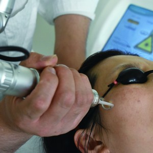 Picosecond ND YAG Laser HS-298