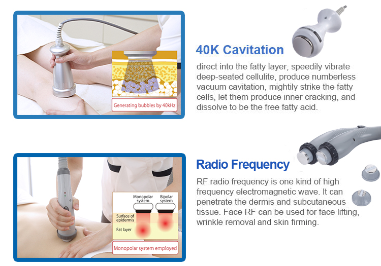 rf cavitation skin lift